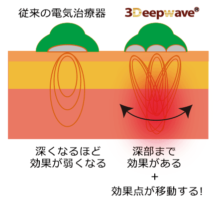 3Deepwave説明