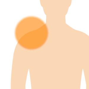 肩・肩の関節の痛み