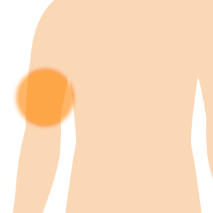 が 痛い 左腕 左腕がとても痛い