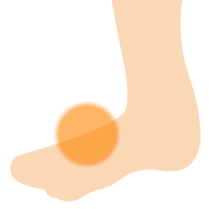 足の甲の痛み