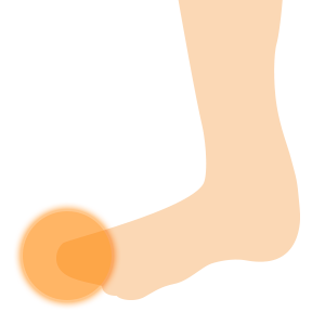 足の指の痛み