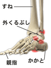 足首の痛みの治療 京王線桜上水 うえた鍼灸整骨院 はれやか整骨院