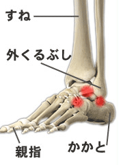 足首の痛みの治療 京王線桜上水 うえた鍼灸整骨院 はれやか整骨院