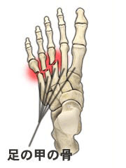 足の甲の痛みの治療 京王線桜上水 うえた鍼灸整骨院 はれやか整骨院