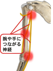 二の腕の痛みの治療 京王線桜上水 うえた鍼灸整骨院 はれやか整骨院